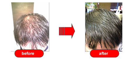 Hiroko Kobayashi - Japanese Miracle hair regrowth manual Do it Yourself 2 Min a Day